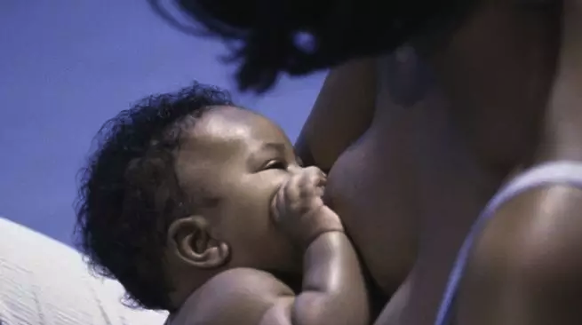 Formula-fed babies have worse jaw alignment and are more likely to need orthodontic work as they get older. This is probably because the sucking action during breastfeeding improves the development of facial muscles and the shape of the palate. Formula-fed babies have worse jaw alignment and are more likely to need orthodontic work as they get older. This is probably because the sucking action during breastfeeding improves the development of facial muscles and the shape of the palate.