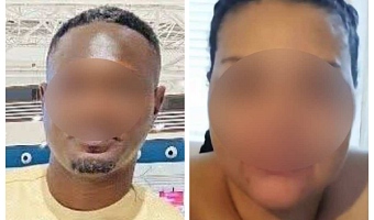 Canadian woman, Ghanaian boyfriend arrested for allegedly burning down Oyarifa apartment