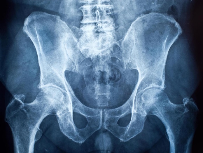 pelvis