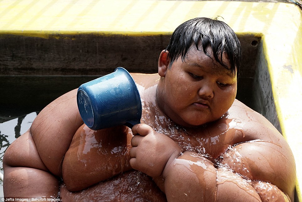 10-year-old is world's fattest boy at 192 kilos