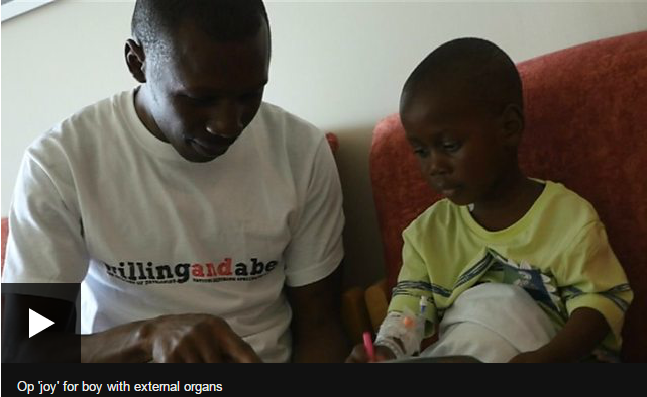 Boy born with organs outside his abdomen has successful surgery