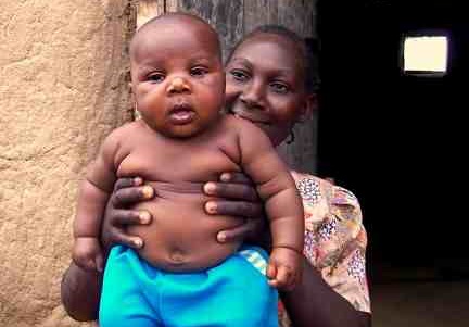 Obese children worried over body size