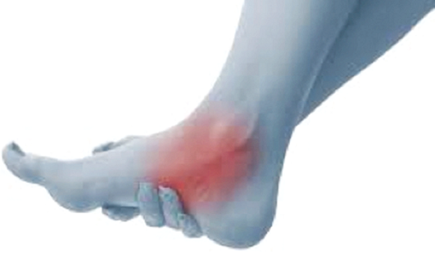 You may feel numbness, tingling sensation and pain in the foot and ankle. You may feel numbness, tingling sensation and pain in the foot and ankle.