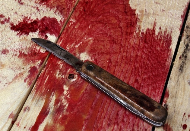 Man chops off hand of girlfriend