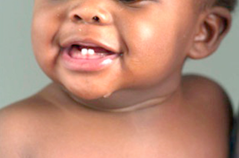 Don’t use tomatoes to clean babies teeth Don’t use tomatoes to clean babies teeth