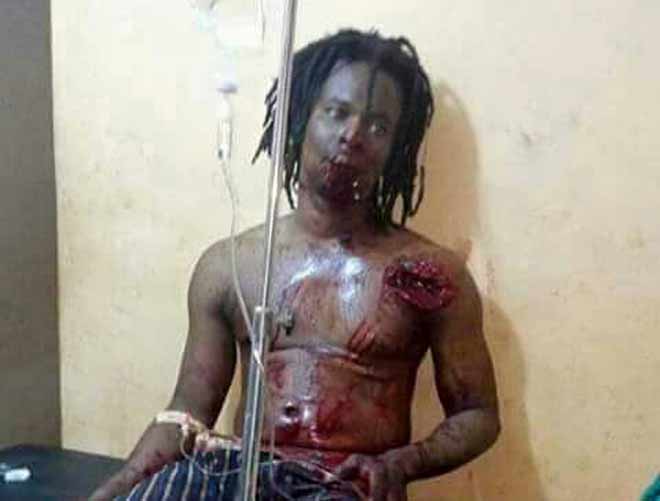 Graphic Online visited the dread-locked fetish priest, Akwasi Addai, a.k.a Nana Tolofasito on his hospital bed on Tuesday. He refused to speak about the incident. Graphic Online visited the dread-locked fetish priest, Akwasi Addai, a.k.a Nana Tolofasito on his hospital bed on Tuesday. He refused to speak about the incident.