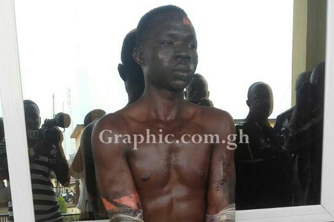 Godfred Yamma, the Jealous lover who burnt ex-girlfriend, three others arrested Godfred Yamma, the Jealous lover who burnt ex-girlfriend, three others arrested