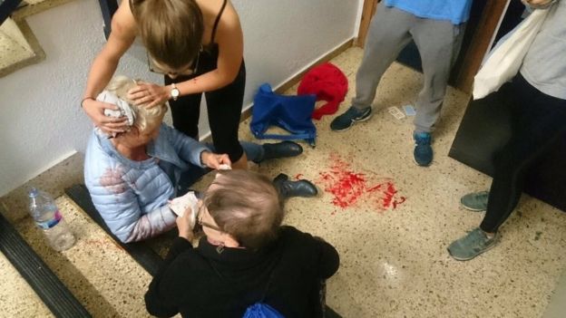 This woman suffered a head injury in Barcelona This woman suffered a head injury in Barcelona