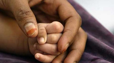 Bent fingers in babies Bent fingers in babies