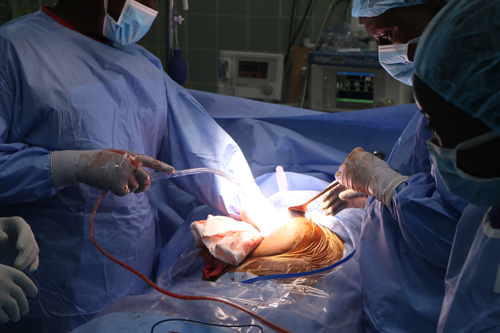 Hope for bile, liver cancer patients; 120 Patients treated at Korle Bu (VIDEO)