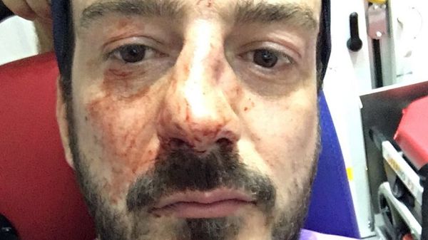 Mr Mélanie shared a photo of his injuries from the assault Mr Mélanie shared a photo of his injuries from the assault