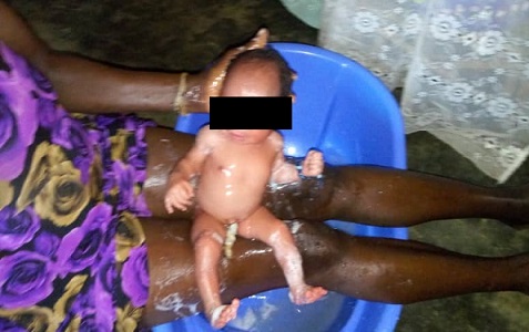 The baby being washed off after its retrieval The baby being washed off after its retrieval