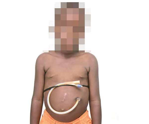One of the children paraded in public by the self-styled philanthropists One of the children paraded in public by the self-styled philanthropists