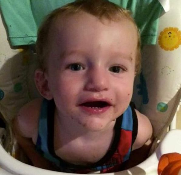 Corby, who lived in Australia, was found to have 81 separate injuries Corby, who lived in Australia, was found to have 81 separate injuries