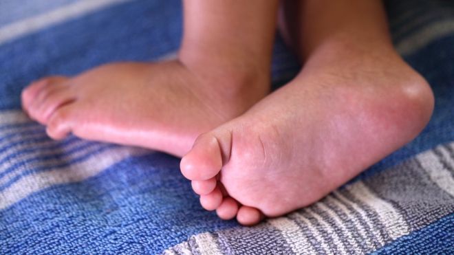 Bangladesh woman with two wombs has twins one month after first birth