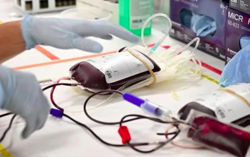 Jehovah's Witnesses can have their own blood removed for pre-planned surgeries