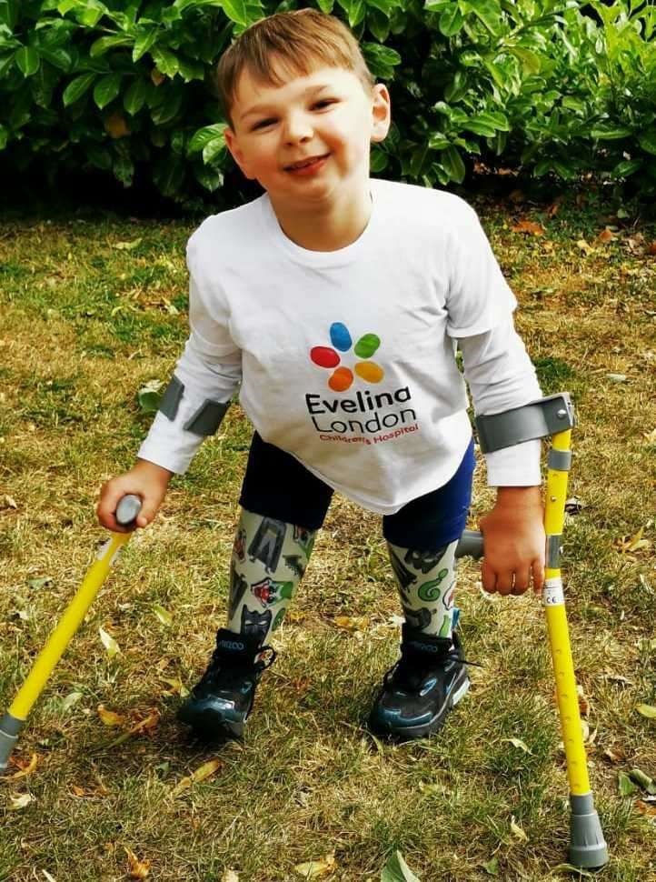 LIBRARY PHOTO Five-year-old British double amputee raises one million pounds