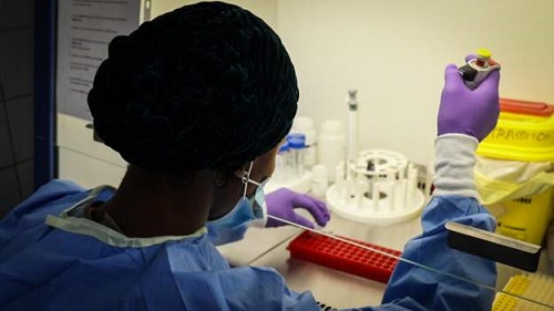 Meningitis is a potentially fatal disease Meningitis kills 120 in DR Congo