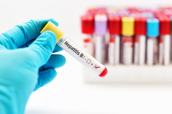 Getting tested, treatment for Hepatitis B