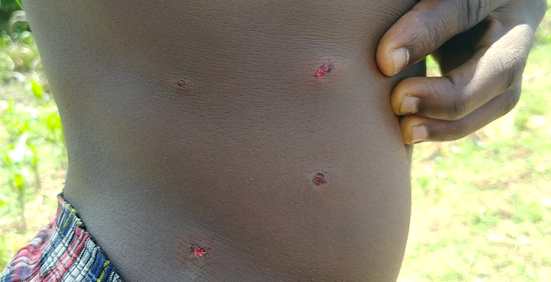 A victim of the shooting incident bearing gunshot wounds