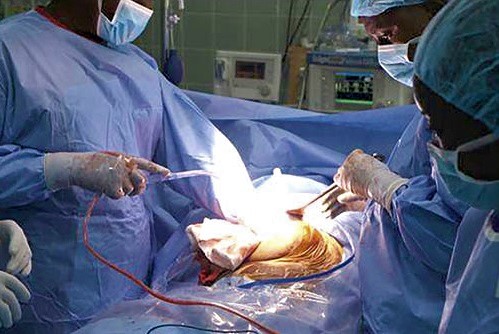 A team of doctors performing surgery on a patient