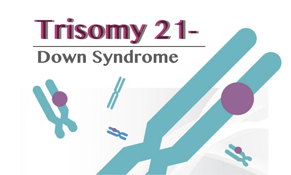 Down syndrome is a condition in which a child inherits extra genetic material from his or her parents What do you know about World Down Syndrome Day?