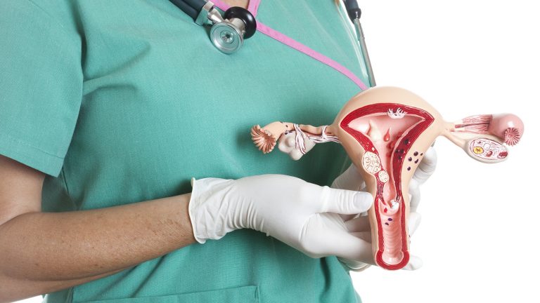 Misconceptions affect fight against cervical cancer