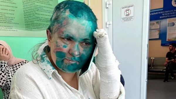 Yelena Milashina, who had her head shaved and her face doused in green dye during the assault, has been attacked in Chechnya before Yelena Milashina, who had her head shaved and her face doused in green dye during the assault, has been attacked in Chechnya before