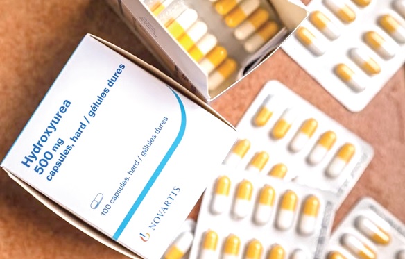 Hydroxyurea - the ‘wonder drug’ for management of Sickle Cell Disease Hydroxyurea - the ‘wonder drug’ for management of Sickle Cell Disease
