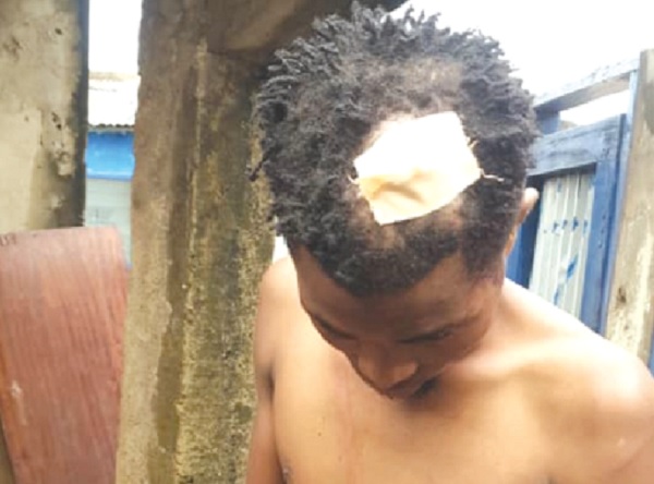 • A resident allegedly beaten by the soldiers • A resident allegedly beaten by the soldiers