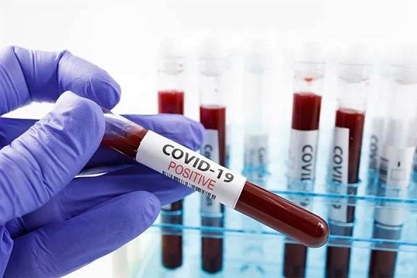 COVID-19 still here, observe protocol — Dr James Duah