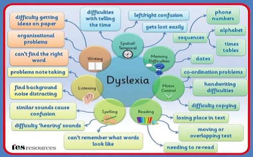 How dyslexia works How dyslexia works