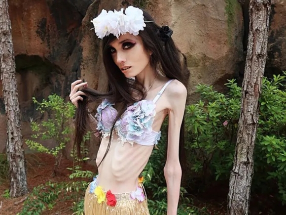 YouTuber Eugenia Cooney's Frail Appearance Triggers 911 Calls