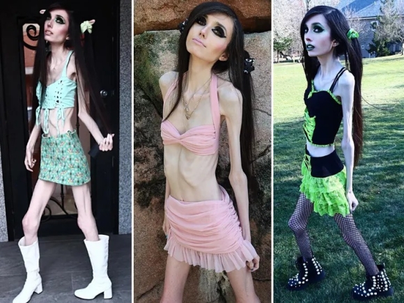 YouTuber Eugenia Cooney's Skinny Appearance Triggers 911 Calls YouTuber Eugenia Cooney's Frail Appearance Triggers 911 Calls