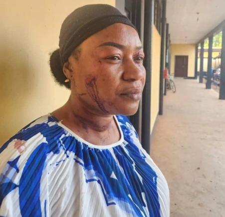 NDC Northern Regional Vice Chairman suspended for assaulting treasurer