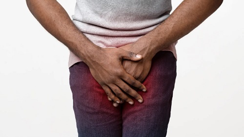 Genital disappearance/shrinking rumour and matters arising