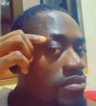 Movie actor Lil Win displays the effects of the May 25 vehicle accident [VIDEO]