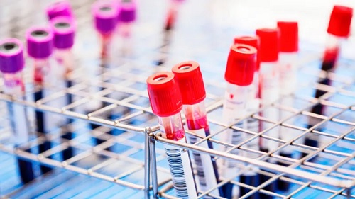Scientists say they can cut HIV out of cells Scientists say they can cut HIV out of cells