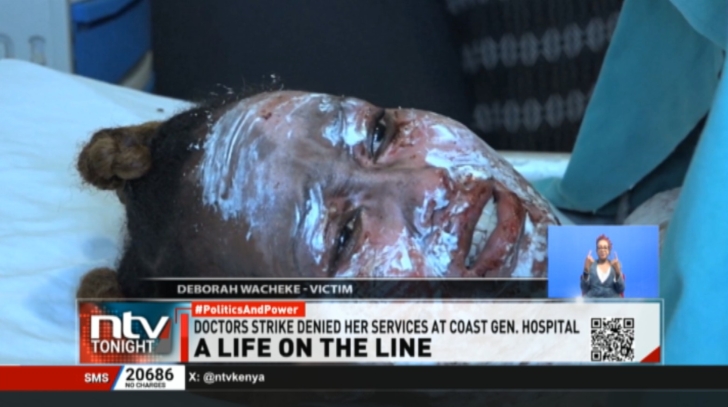 Mombasa woman fights for her life after boyfriend burnt her with hot oil Kenyan woman battles for her life after boyfriend scalds her with hot oil
