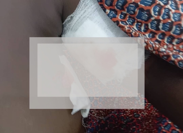 Jealous husband shoots wife over infidelity allegation
