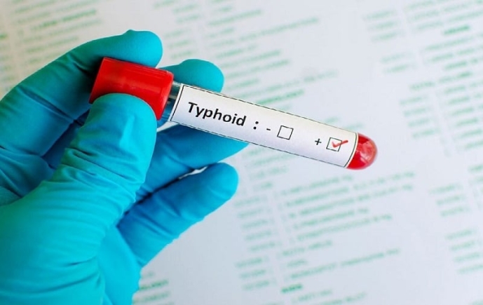 Typhoid fever outbreak in Oti Region — GHS deploys rapid response team