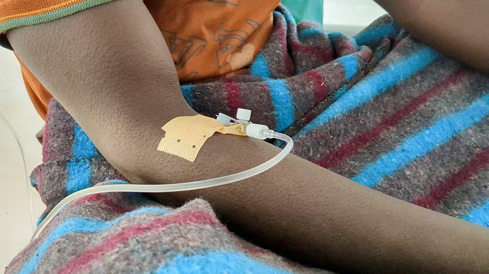 An artisanal gold miner receives a medical-drip inside a ward at the cholera treatment centre run by Medecins Sans Frontieres (MSF - Doctors without Borders) following a cholera outbreak that has swept through, overwhelming a fragile health system and underscoring the risks faced by thousands of miners and traders living without clean water or sanitation, in Lomera within Luhihi mining zone, in South Kivu province near Bukavu, Democratic Republic of Congo June 18, 2025. REUTERS/Crispin Kyalangalilwa/File Photo