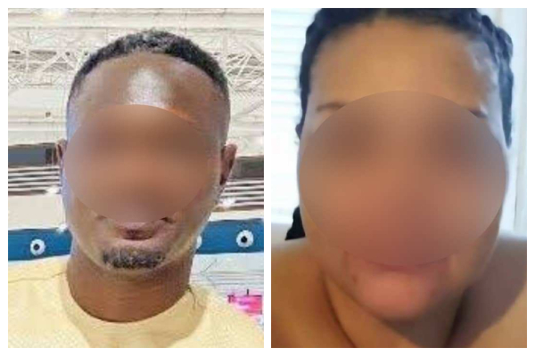 Canadian woman, Ghanaian boyfriend arrested for allegedly burning down Oyarifa apartment