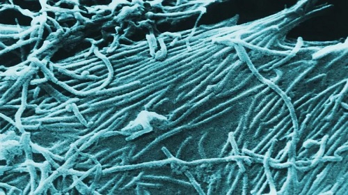 Uganda's last Ebola outbreak was in 2022 Uganda's last Ebola outbreak was in 2022