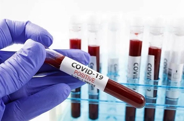 University of Ghana issues alert on Covid-19 resurgence on campus