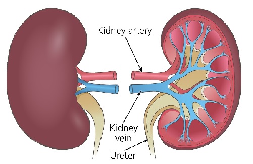 13 out of 100 Ghanaians have some form of kidney disease — Dr Tannor 13 out of 100 Ghanaians have some form of kidney disease — Dr Tannor