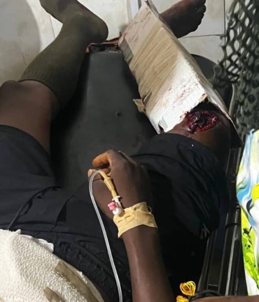 Upper East: Immigration officer killed, another injured in armed attack at Tempane