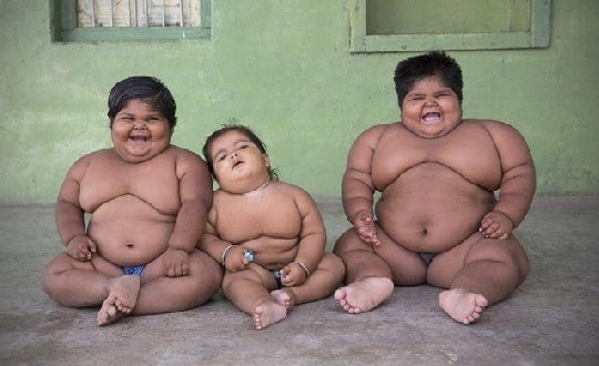One in 10 children worldwide obese One in 10 children worldwide obese