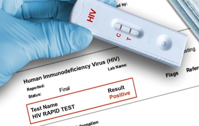 Wrong manufacturer, wrong dates: How to spot the falsified HIV test kits flooding Ghana's market