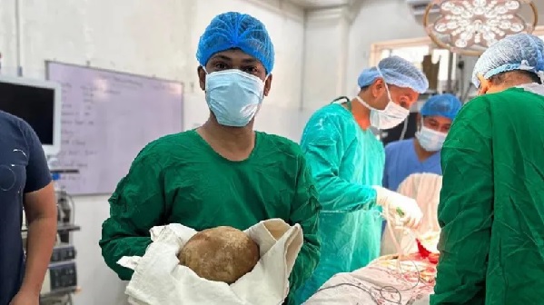 Doctors in Sri Lanka have removed a giant bladder stone that weighs as much as a newborn child